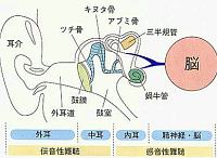���̐}�̉E���̊���������Ă�炵���ł��A���̕a�C�B