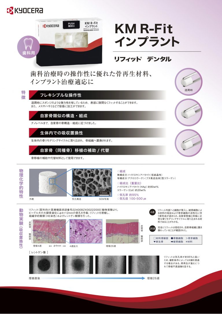 KM R-Fitインプラント