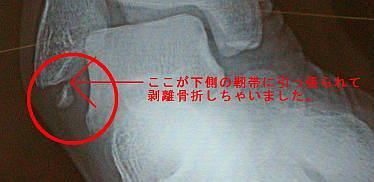 �������܁I