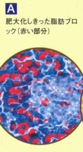 ̂P